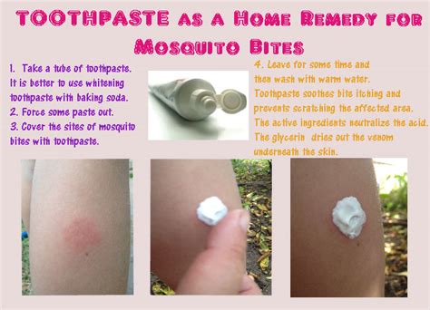 itch sel|How to Soothe Itchy Mosquito Bites .